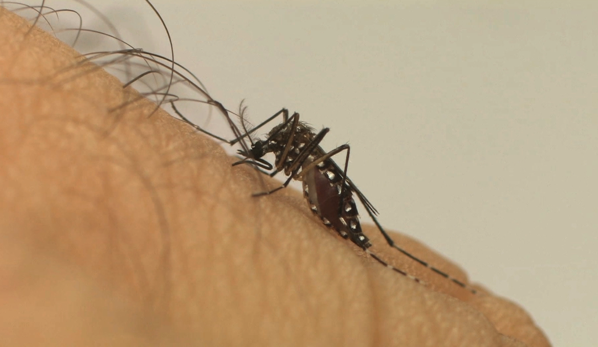 Aedes Aegypti Conheça A Diferença Entre Os Sintomas Da Dengue Zika E
